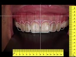 dentist-2014-1211-4