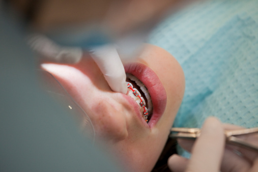 Girl having her braces adjusted by a dentist