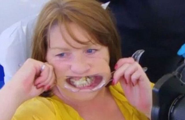 [新聞] 她害怕看牙醫　用萬能膠補牙10年結果…