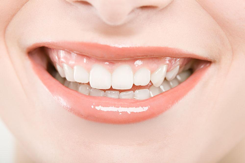 [新聞] 美白牙齒 8種食物讓牙齒越吃越白