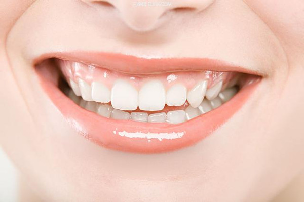 [新聞] 牙齒美白的價格為什麼會這麼貴？