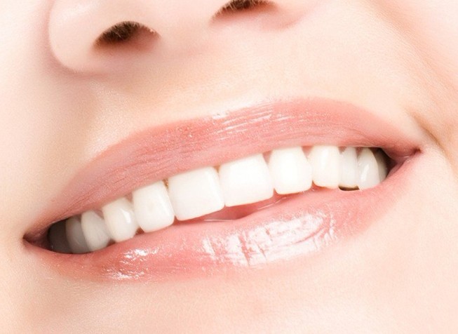 [新聞] 牙齒美白的正確打開方式是啥？看了你就知道了