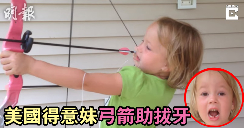 [新聞]  美國5歲囡囡弓箭助拔牙　香港牙醫：咬蘋果仲好