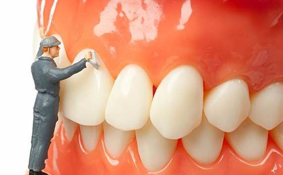 牙齒也有結石！定期洗牙清牙結石維持口腔及牙齒健康!!