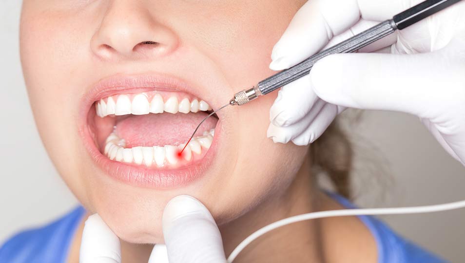 牙周病影響全身健康 清潔最重要