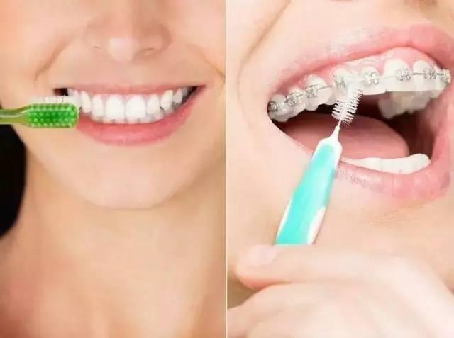 牙膏牙刷怎麼選？有齲齒可以買含氟牙膏、牙周病用間隙刷 　