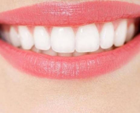 美白資訊：最輕鬆有效的居家牙齒美白產品