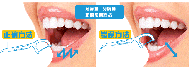 使用牙線清潔牙齒會使牙縫變大嗎？