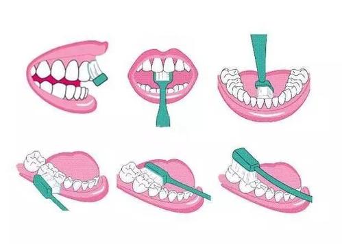 牙膏擠太多也會導致口腔疾病？正確刷牙是這4步