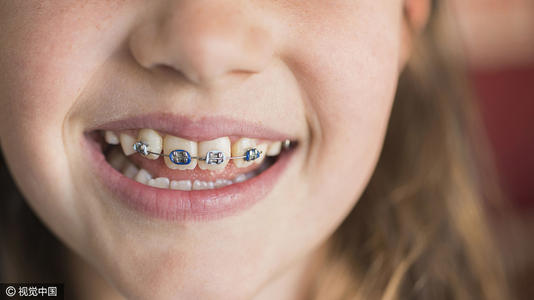 兒童矯正牙齒的3個黃金時間段，千萬不能錯過最佳時機~